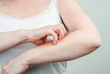 Luôn cảm thấy ngứa, người phụ nữ 59 tuổi "sốc" khi biết mình mắc liền 2 căn bệnh nguy hiểm này