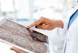 Đột quỵ do xuất huyết não đang gia tăng ở người trẻ: Đây là "thủ phạm" hàng đầu