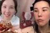 Mặt cô gái trẻ biến dạng sau 2 năm làm mukbang, bác sĩ cảnh báo 4 cái giá phải trả về sức khỏe ít ai biết đến