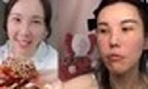 Mặt cô gái trẻ biến dạng sau 2 năm làm mukbang, bác sĩ cảnh báo 4 cái giá phải trả về sức khỏe ít ai biết đến