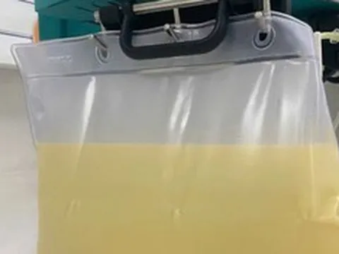 Nam thanh niên 29 tuổi "máu chuyển trắng như sữa" vì uống thứ nước quen thuộc suốt 6 tháng