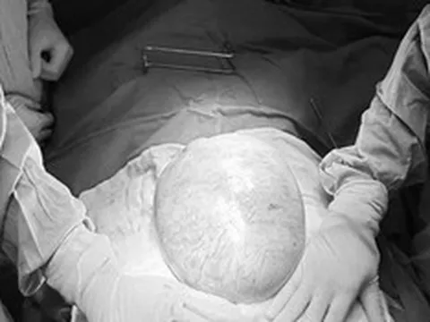 Bé gái 16 tuổi bụng to bất thường, bố mẹ sốc khi phát hiện bí mật "đáng sợ" bên trong