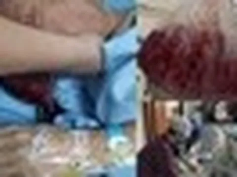Người đàn ông nôn ra hơn 2 lít máu trong 5 phút, bác sĩ cảnh báo: 4 thói quen ăn uống "phá nát" dạ dày