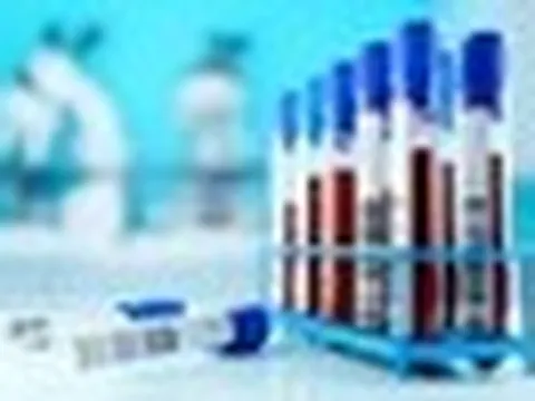 5 xét nghiệm nên làm khi bước sang tuổi 35