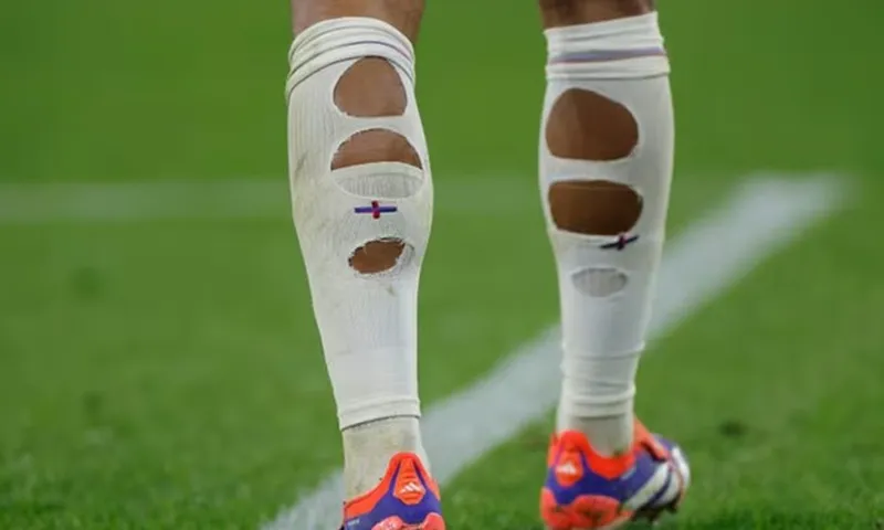 Vì sao nhiều cầu thủ World Cup lại mang tất "thủng lỗ chỗ"?